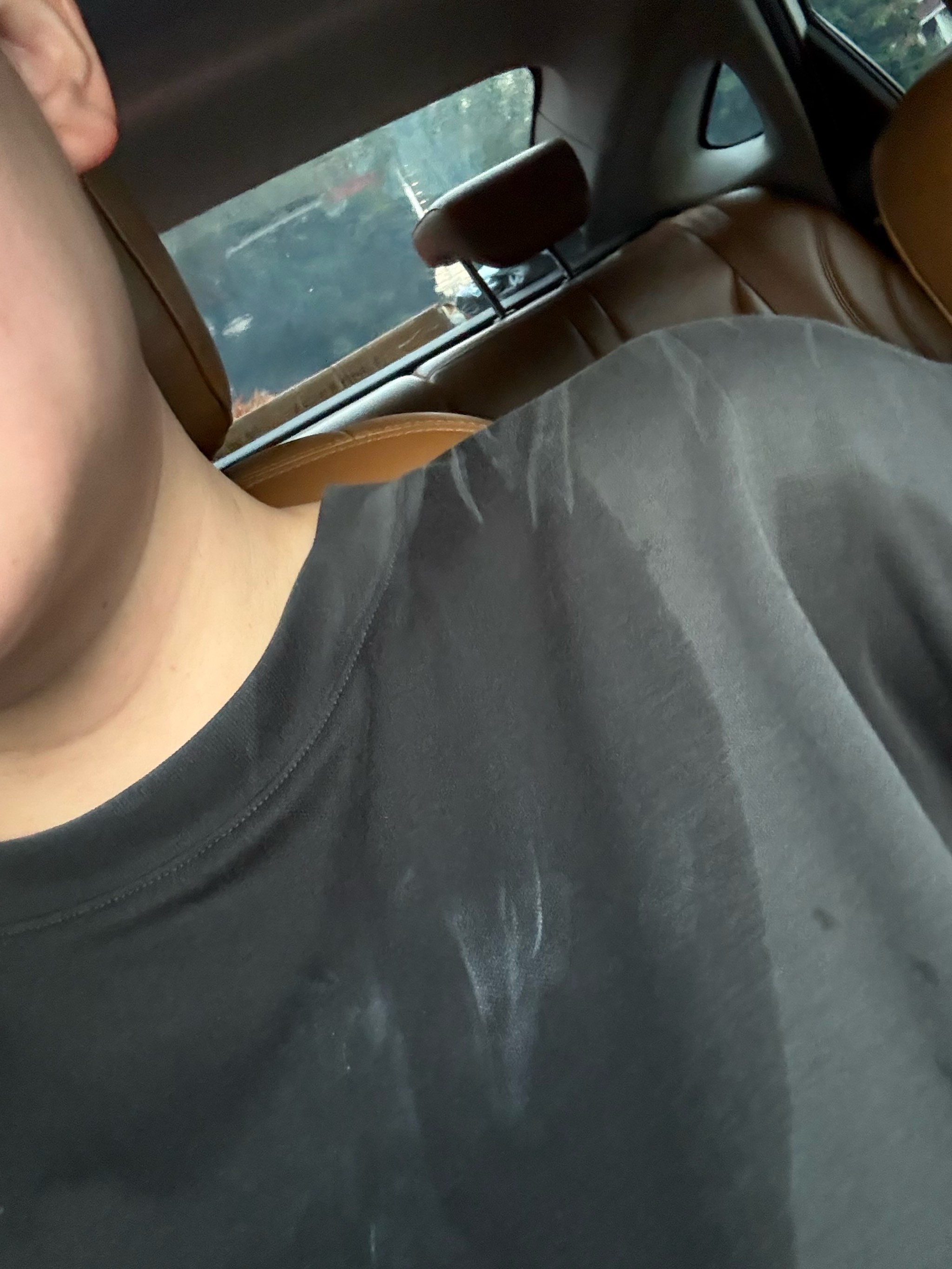 钉穿入骨骼 钉穿入骨骼